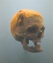 Cranio ritrovato con ancora il nodo svevo