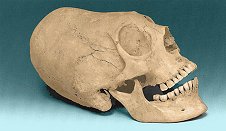 cranio unno